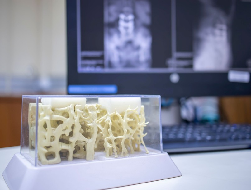 csontfájdalom Miért gyengülnek csontok