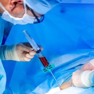 Mi a csontvelő-transzplantáció? című cikk nyitóképe