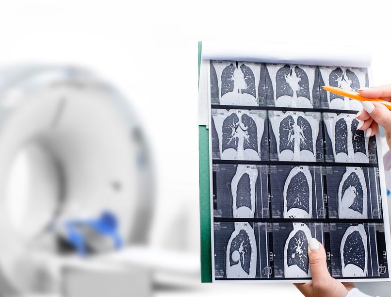 rák daganat tumor szűrővizsgálat