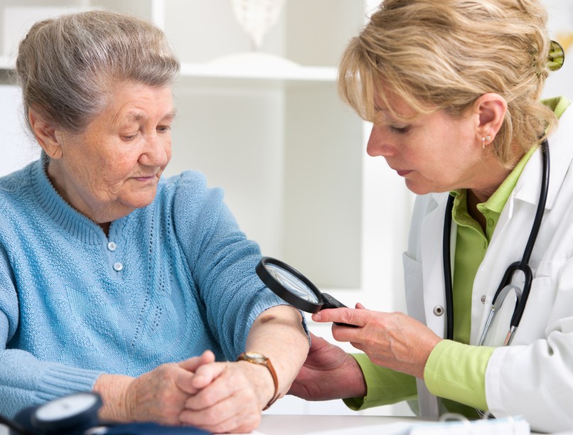 melanóma, bőrrák, bőrbetegség, tünet, daganatos betegségek