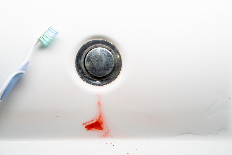 Ínyvérzés: ezek állhatnak a probléma hátterében