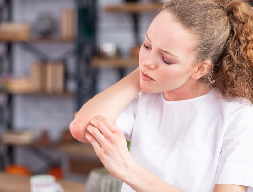 Akinek pikkelysömöre van, nagyobb az esélye az infarktusra