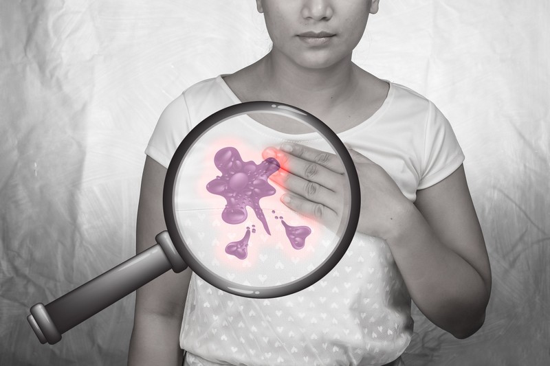 Mellrák és gombák: lehet, hogy a gombák lesznek az új szövetségeseink