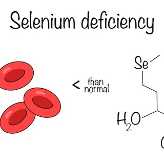 Szelénhiány tünetei, vizsgálata és kezelési lehetőségei című cikk nyitóképe