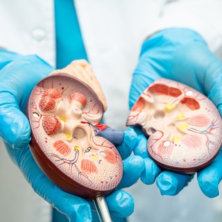 Másfél millió magyar veséje lehet veszélyben – sokan nem is tudnak róla című cikk nyitóképe