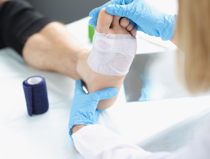 lábamputáció, seb, láb, figyel, fekély, érszűkület, cukorbeteg