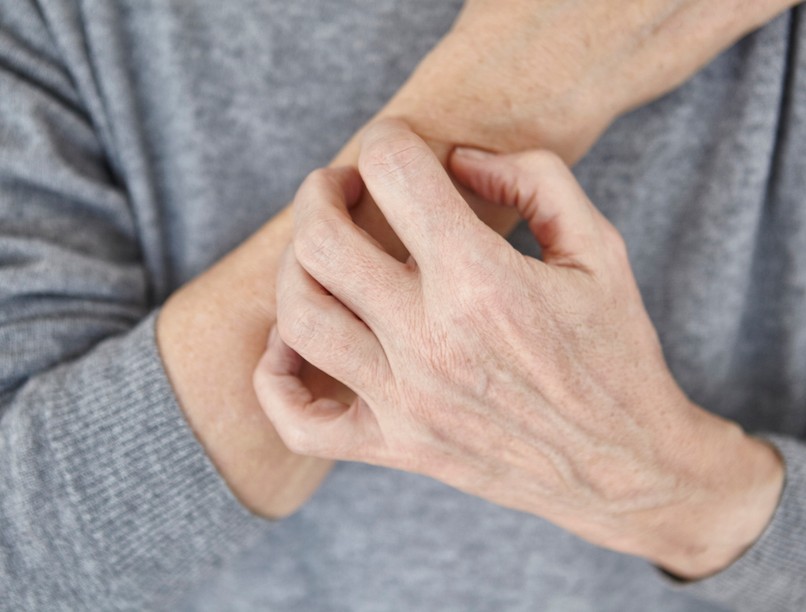 jódhiány, jód, pajzsmirigy, viszketés