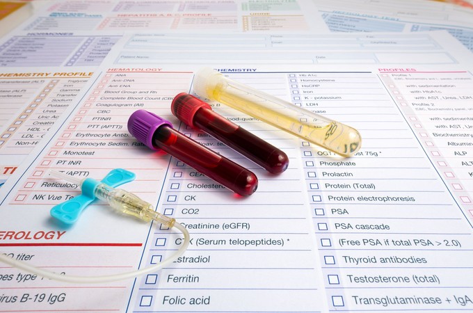 Mit mutat meg a vérkép? Ezekről árulkodnak a biomarkerek című cikk nyitóképe