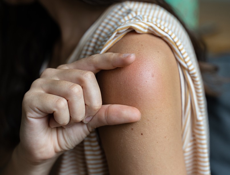 oltási reakció, koronavírus, mellékhatás, covid-19