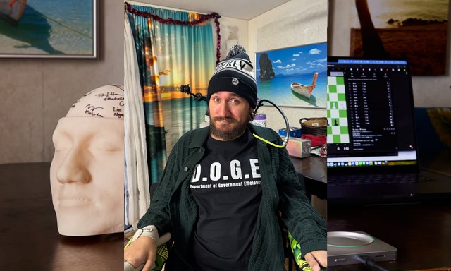 Elon Musk chipet helyezett egy bénult férfi agyába, aki képessé vált az elméjével mozgatni dolgokat