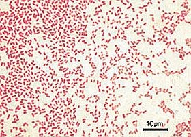 Fehérjékkel - a baktériumok ellen?