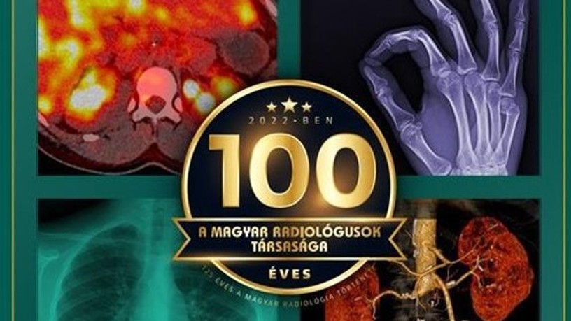 röntgen, radiológia, röntgensugár, X-sugárzás, Nobel-díj