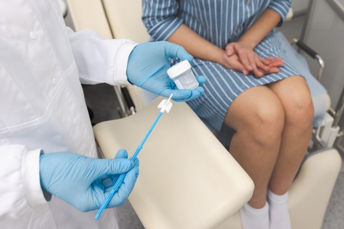 Mikor kell citológiát végezni? című cikk nyitóképe