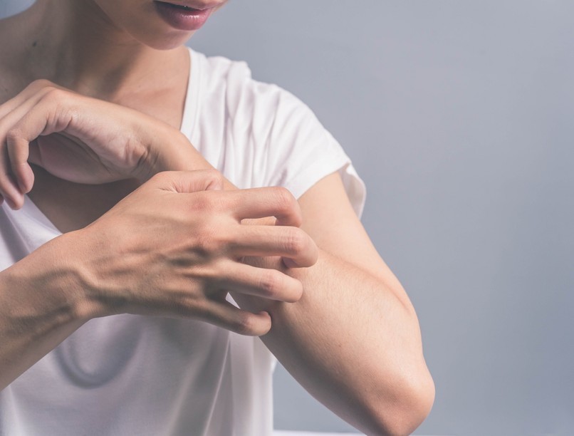 cukorbetegség, tünet, szem bőr