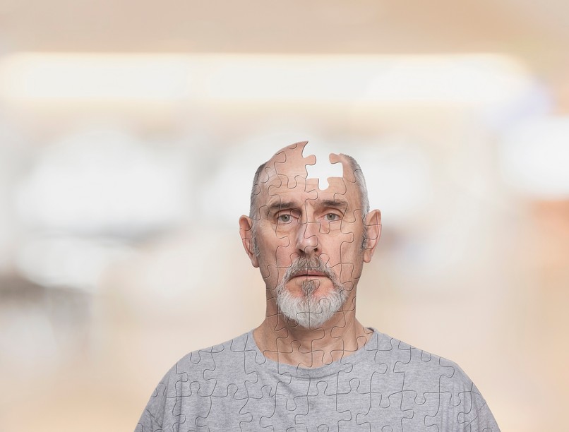 alzheimer-kór, új forma, tudós, ok