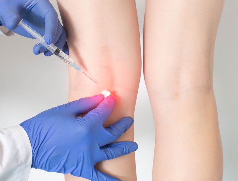 nyaralás előtt ízületi fájdalomcsillapító