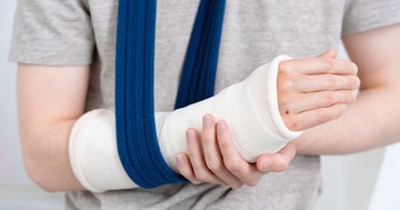 Nem ér véget a gyógyulás a gipsz levételével – sőt, ott kezdődik igazán