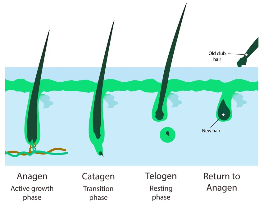 A telogén effluvium lényege, hogy a hajszálak között a nyugalmi fázisban lévők száma hirtelen megnövekszik, és viszonylag gyorsan érkezik el a telogén fázis, vagyis a hajhullás.