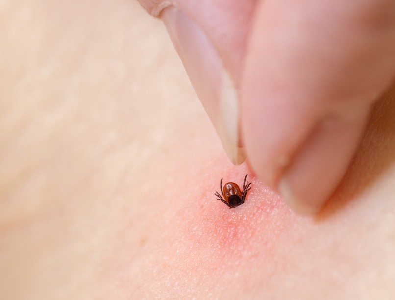 kullancs, kiszedés, lmye-kór, élősködő