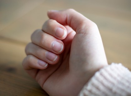 Tényleg vitaminhiányt jeleznek a körmön megjelenő fehér foltok? című cikk nyitóképe