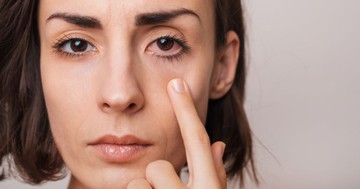  Mit jelent, ha viszket a bal szemem? 