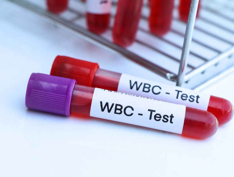 Leukocyta, WBC, magas oka miért