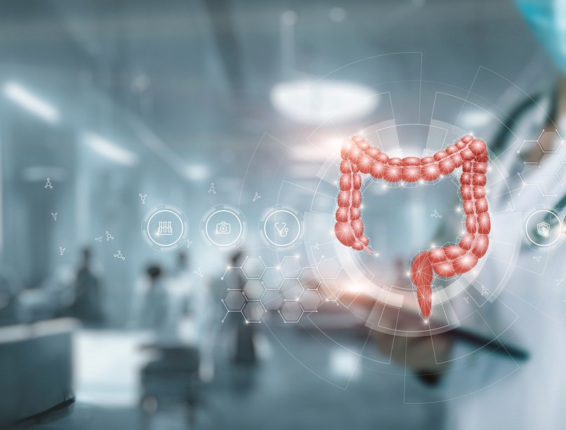 vastagbél szűrés vastagbéldaganat vastagbéltükrözés erdemény