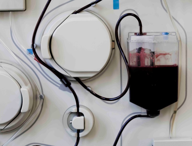 plazmaferezis plazmacsere leírás