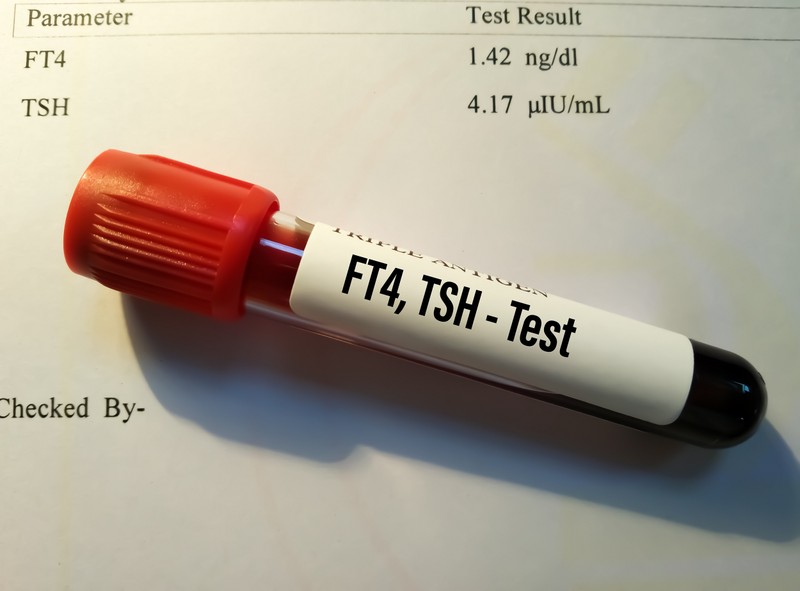 Mit jelent a FT4 (szabad T4) érték a laborleleten?