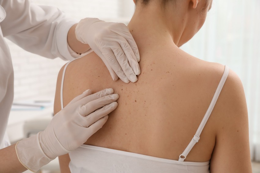 Az elmúlt 20 évben a nem melanoma típusú bőrrákos megbetegedések száma több mint a másfélszeresére nőtt.