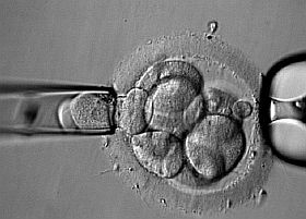 A mesterséges megtermékenyítés veszélyei?