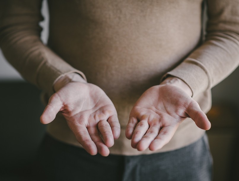 pajzsmirigyzavar, tünet bőr sárga tenyér