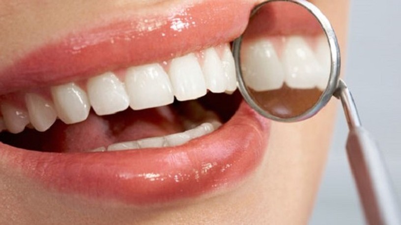 is-diy-teeth-whitening-good-for-you-banner_2