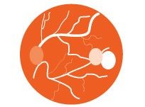 Időskori makula-degeneráció (AMD): tünetek és kezelési lehetőségek