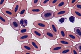 Aszpirinnel védekezik a trombózis ellen? Nem biztos, hogy használ!