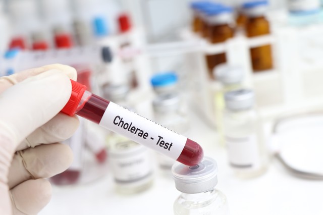 Kolera: tünetei, vizsgálata és kezelési lehetőségei