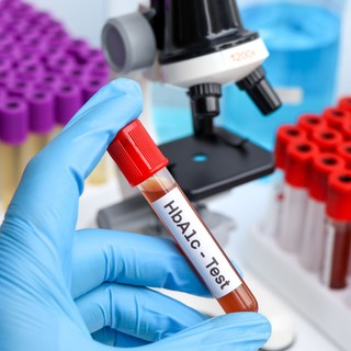 HbA1c - tudja meg, mi ez és miért nézik folyton cukorbetegség esetén című cikk nyitóképe