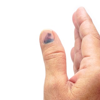 Csak szépséghiba, vagy komoly baj? Ezt árulhatják el a körmei az egészségéről című cikk nyitóképe