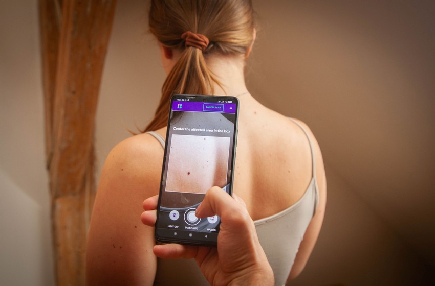 Szintetikus képeket tudnak alkotni olyan ritka bőrbetegségekről is, amelyekről jelenleg kevés információ áll rendelkezésre.