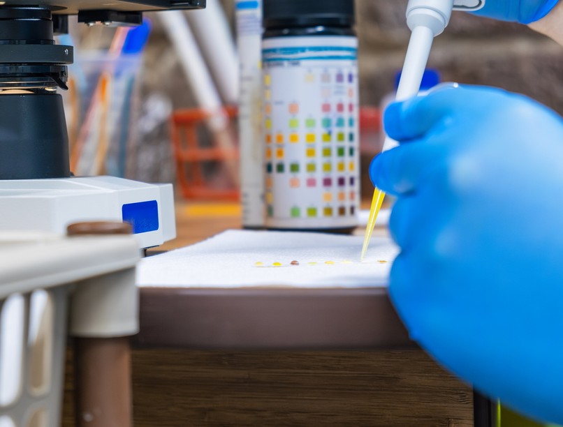 Mit jelent nitrit érték laborlelet