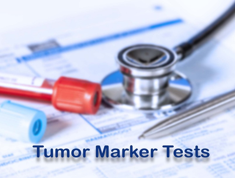 tumormarker-vizsgálat onkológiai markervizsgálat leírás