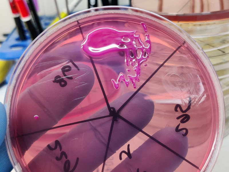 Fertőzés a koraszülött intenzíven: időben kiszűrték a Klebsiella-baktériumot szegediek