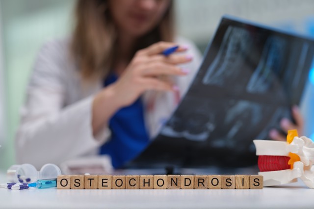 Oszteokondróma: tünetek, vizsgálatok és kezelési lehetőségek