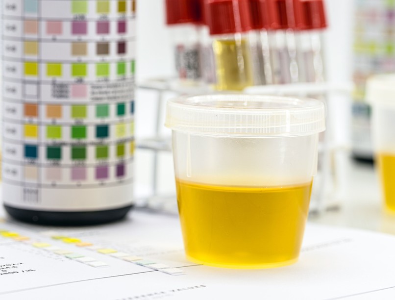 vizelet vizsgálat étel kerül