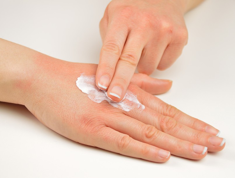 bőrápolás, száraz bőr, körömágy, bőrszárazság, kamilla, hidratálás