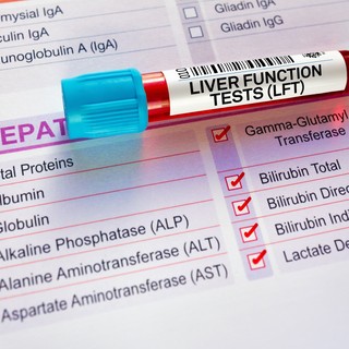 Hogyan csökkenthető a GGT-érték? című cikk nyitóképe