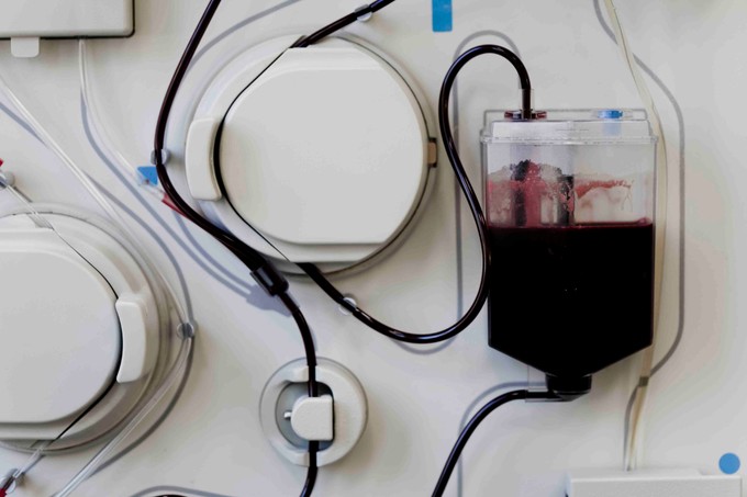 Mit jelent a plazmaferezis? című cikk nyitóképe