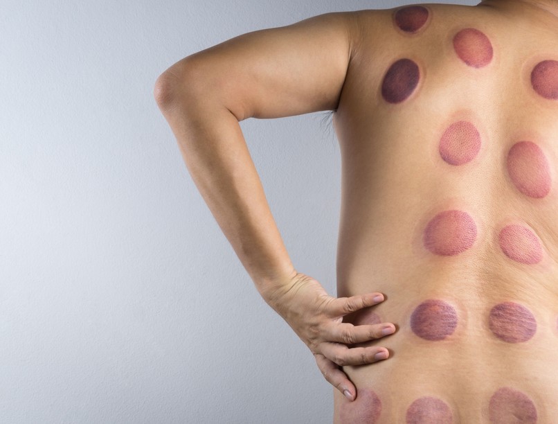 úszó hát sötét folt miért