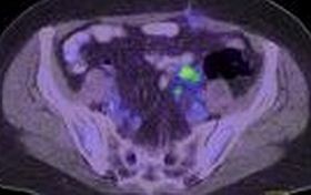 Extrém diagnosztika: múmiákat vizsgáltak CT-vel!