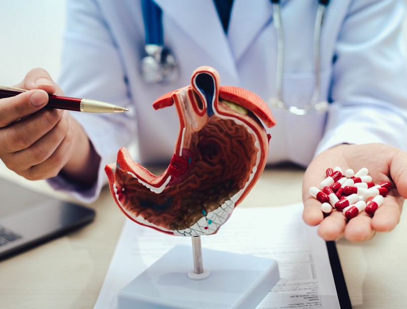 milyen fájdalomcsillapítót szedhetek reflux sav ellen